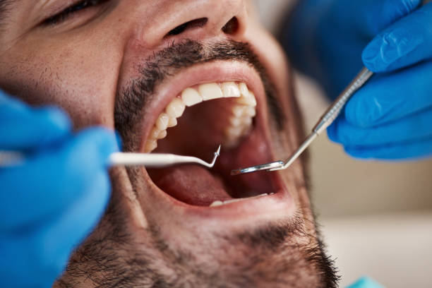 Best Emergency Dental Care for Broken or Chipped Teeth in Monmouth, IL